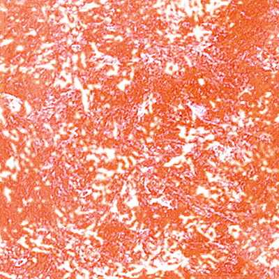 DS-644