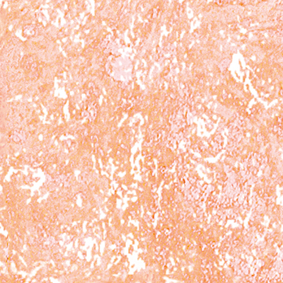 DS-635