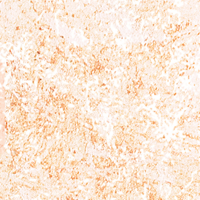 DS-625