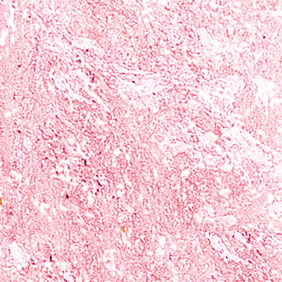 DS-601