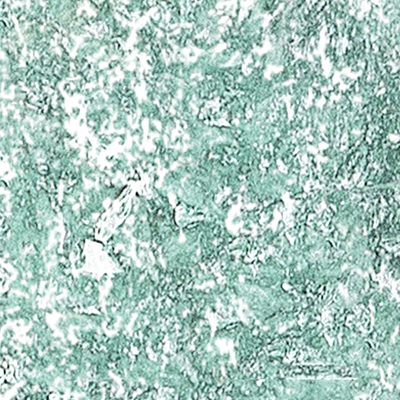 DS-638