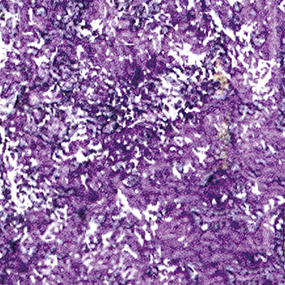 DS-696