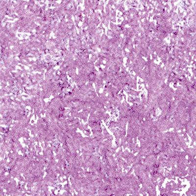 DS-695