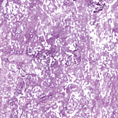 DS-694