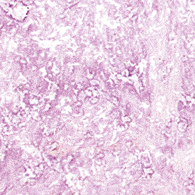 DS-693