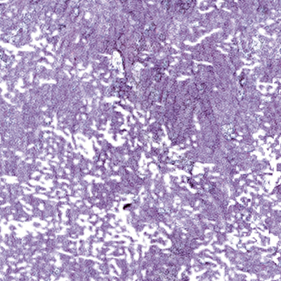 DS-687