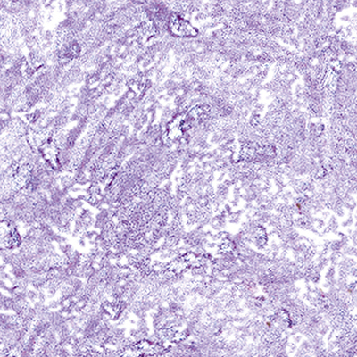 DS-686