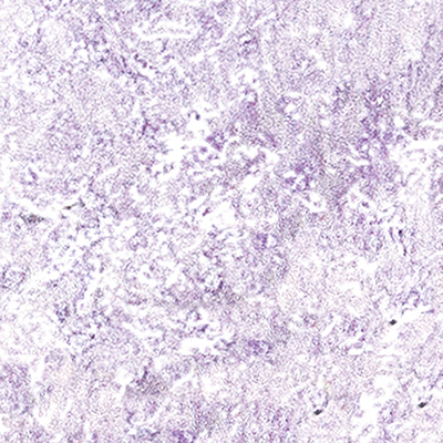 DS-685
